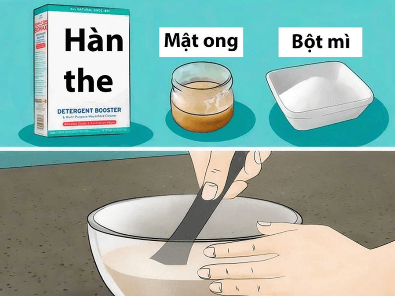 Ti&ecirc;u diệt gi&aacute;n bằng h&agrave;n the v&agrave; mật ong